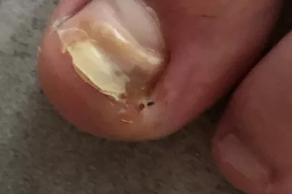 Bigger view of Med pedicure